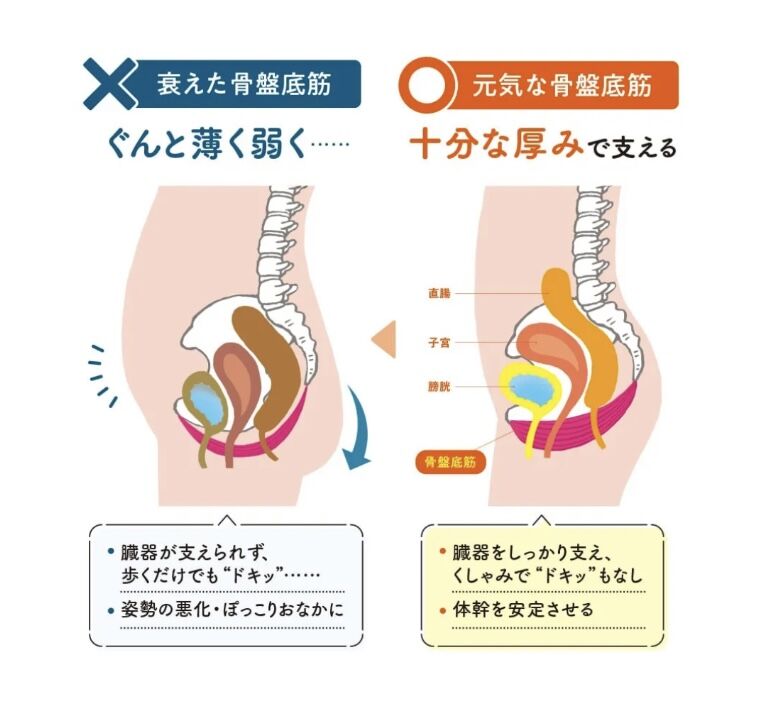 骨盤底筋が緩む原因